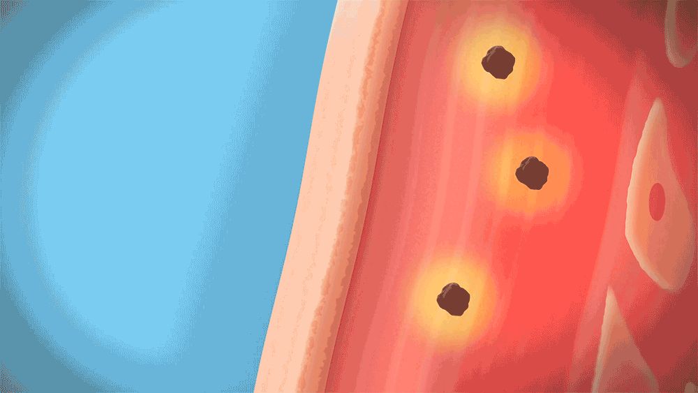 8504add5cf095b5b78883632423eb6b1_1744244593_6109.gif
